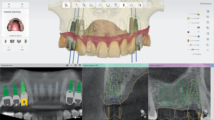 Digitale Abdrucknahme – mit 3Shape TRIOS Intraoralscanner. Jetzt in unserer Praxis!