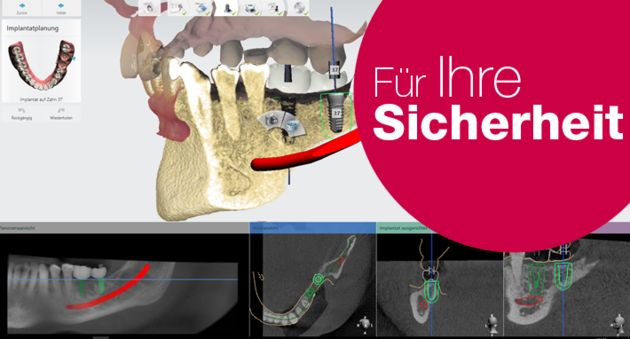 Digitale Implantatplanung – höhere Sicherheit, größere Präzision, bessere Kommunikation