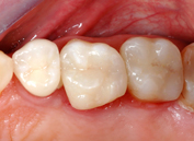 Ästhetische Zahnmedizin - Dr. Frank Wertmann - Zahnarzt in Potsdam